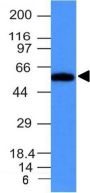 Fascin-1(FSCN1/417), CF488A conjugate, 0.1mg/mL