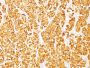 MART-1 / Melan-A / MLANA (Melanoma Marker)(DT101 + BC199),  CF488A conjugate, 0.1mg/mL
