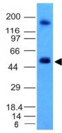 Carbonic Anhydrase IX(CA9/781), CF488A conjugate, 0.1mg/mL