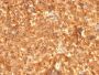 AFP (Alpha Fetoprotein)(C2 + C3 + MBS-12), CF488A conjugate, 0.1mg/mL