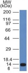 ALK (Anaplastic Lymphoma Kinase) / CD246(ALK/1031), CF488A conjugate, 0.1mg/mL
