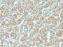 Ep-CAM / CD326 (Epithelial Marker) (EGP40/1555R), CF488A conjugate, 0.1mg/mL