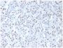 Wilm's Tumor 1 (WT1) (Wilm's Tumor & Mesothelial Marker), CF488A conjugate, 0.1mg/mL