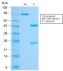 FOXA1 / HNF3A (FOXA1/2230R), CF488A conjugate, 0.1mg/mL