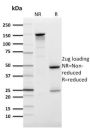 GLUT-1 (Tumor Progression and Mesothelioma Marker) (GLUT1/2476), CF488A conjugate, 0.1mg/mL