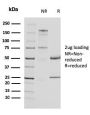 Uroplakin 1A (Urothelial Differentiation Marker)(UPK1A/2924), CF488A conjugate, 0.1mg/mL