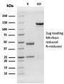 Human Herpes Virus 8 (HHV8)(HHV8/3606), CF488A conjugate, 0.1mg/mL