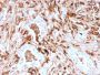 Ferritin, Light Chain (Node-Negative Breast Tumor Prognostic Marker)(rFTL/1388), CF488A conjugate, 0.1mg/mL