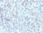 TRP1 (Tyrosinase Related Protein 1)(TYRP1/807), CF594 conjugate, 0.1mg/mL