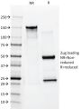 Cytokeratin 10 (Suprabasal Epithelial Marker)(AE20), CF594 conjugate, 0.1mg/mL