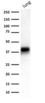Ep-CAM / CD326 (Extracellular Domain) (Epithelial Marker) (EGP40/1372), CF594 conjugate, 0.1mg/mL
