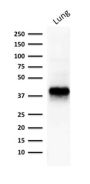 Ep-CAM / CD326 (Extracellular Domain) (Epithelial Marker) (EGP40/1373), CF594 conjugate, 0.1mg/mL