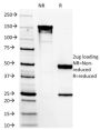 DOG-1 / TMEM16A (Gastrointestinal Stromal Tumor Marker) (DG1/1485), CF594 conjugate, 0.1mg/mL