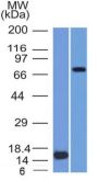 MMP2 / Collagenase Type IV A (Tumor Metastasis Marker) (MMP2/1501), CF594 conjugate, 0.1mg/mL