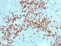 MMP9 (Matrix Metalloproteinase 9)(2C3), CF594 conjugate, 0.1mg/mL