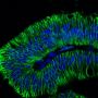 Ep-CAM / CD326 (Extracellular Domain) (Epithelial Marker) (EGP40/1798), CF594 conjugate, 0.1mg/mL