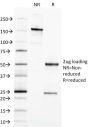 Ep-CAM / CD326 (Extracellular Domain) (Epithelial Marker) (EGP40/1798), CF594 conjugate, 0.1mg/mL
