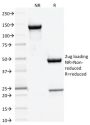DNMT3A / DNA Methyltransferase 3 Alpha (PCRP-DNMT3A-1E2), CF594 conjugate, 0.1mg/mL