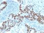 p53 Tumor Suppressor Protein (PCRP-TP53-1F7), CF594 conjugate, 0.1mg/mL