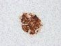 Insulin / IRDN (beta-Cell & Insulinoma Marker) (rIRDN/805), CF594 conjugate, 0.1mg/mL
