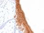 Cytokeratin 10 (KRT10) (Suprabasal Epithelial Marker) (rKRT10/844), CF594 conjugate, 0.1mg/mL