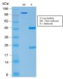 ACTH (Adrenocorticotrophic Hormone) (Pituitary Marker) (CLIP/2040R), CF594 conjugate, 0.1mg/mL