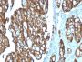 TACSTD2 / TROP2 (Epithelial Marker) (TACSTD2/2151), CF594 conjugate, 0.1mg/mL