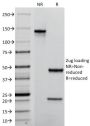 TACSTD2 / TROP2 (Epithelial Marker) (TACSTD2/2152), CF594 conjugate, 0.1mg/mL