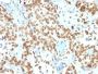Emerin (Papillary Thyroid Carcinoma and EDMD Marker) (EMD/2167), CF594 conjugate, 0.1mg/mL