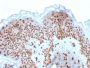 Emerin (Papillary Thyroid Carcinoma and EDMD Marker) (EMD/2167), CF594 conjugate, 0.1mg/mL