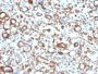 Emerin (Papillary Thyroid Carcinoma and EDMD Marker) (EMD/2167), CF594 conjugate, 0.1mg/mL