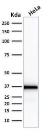 Emerin (Papillary Thyroid Carcinoma and EDMD Marker) (EMD/2167), CF594 conjugate, 0.1mg/mL