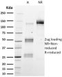 Emerin (Papillary Thyroid Carcinoma and EDMD Marker) (EMD/2167), CF594 conjugate, 0.1mg/mL