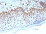 Emerin (Papillary Thyroid Carcinoma and EDMD Marker) (EMD/2168), CF594 conjugate, 0.1mg/mL