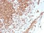 Emerin (Papillary Thyroid Carcinoma and EDMD Marker) (EMD/2168), CF594 conjugate, 0.1mg/mL