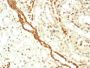 Emerin (Papillary Thyroid Carcinoma and EDMD Marker) (EMD/2168), CF594 conjugate, 0.1mg/mL