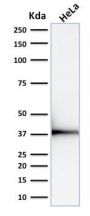 Emerin (Papillary Thyroid Carcinoma and EDMD Marker) (EMD/2168), CF594 conjugate, 0.1mg/mL