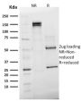 Emerin (Papillary Thyroid Carcinoma and EDMD Marker) (EMD/2168), CF594 conjugate, 0.1mg/mL