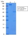 Cytokeratin 8 (KRT8) (rB22.1), CF594 conjugate, 0.1mg/mL