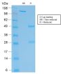 HCG-beta (Pregnancy & Choriocarcinoma Marker) (rHCGb/54), CF594 conjugate, 0.1mg/mL