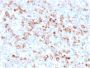 Tyrosinase (Melanoma Marker)(rOCA1/812), CF594 conjugate, 0.1mg/mL