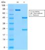 MUC1 / CA15-3 / EMA / CD227 (Epithelial Marker) (MUC1/2278R), CF594 conjugate, 0.1mg/mL