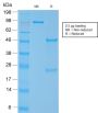 Smooth Muscle Myosin Heavy Chain (SM-MHC) (MYH11/2303R), CF594 conjugate, 0.1mg/mL