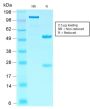 SOX10 (Melanoma Marker) (SOX10/2311R), CF594 conjugate, 0.1mg/mL