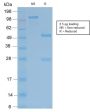 TRAcP (Tartrate-Resistant Acid Phosphatase) (Hairy Cell Leukemia Marker) (ACP5/2336R), CF594 conjugate, 0.1mg/mL