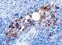 TRAcP (Tartrate-Resistant Acid Phosphatase) (Hairy Cell Leukemia Marker) (rACP5/1070), CF594 conjugate, 0.1mg/mL