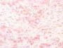 Tyrosinase-Related Protein-1 (TYRP-1) (Melanoma Marker) (TYRP1/2340R), CF594 conjugate, 0.1mg/mL