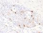 Tyrosinase-Related Protein-1 (TYRP-1) (Melanoma Marker) (TYRP1/2340R), CF594 conjugate, 0.1mg/mL