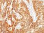 EGFR (Epidermal Growth Factor Receptor) (GFR/2341), CF594 conjugate, 0.1mg/mL