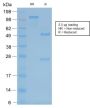 Neurofilament (NF-H) (Neuronal Marker) (rNF421), CF594 conjugate, 0.1mg/mL
